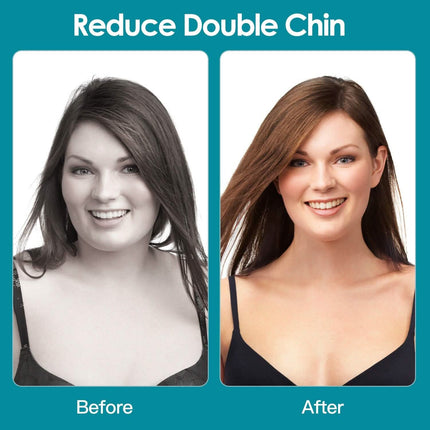 4-Pack: Jawline Exerciser with 3 Resistance Levels