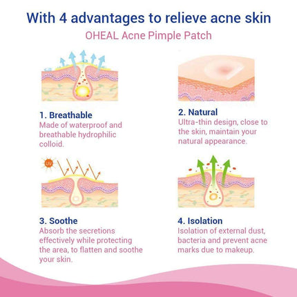 Blemish and Acne Treatment Skin Healing Spot Patches