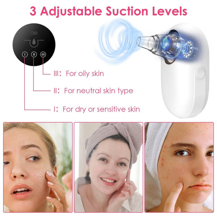 Electric Blackhead Comedone Extractor Tool Facial Pore Cleaner
